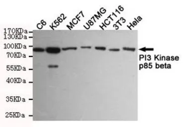 Anti-PI3 kinase p85 beta antibody [8D9-D5-F8] used in Western Blot (WB). GTX16481