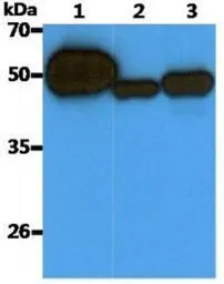 Anti-Cytokeratin 20 antibody [AT10D8] used in Western Blot (WB). GTX16500