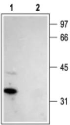 Anti-Stargazin antibody used in Western Blot (WB). GTX16605