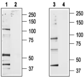 Anti-VRL1 antibody used in Western Blot (WB). GTX16610