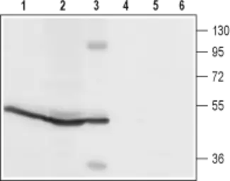 Anti-Orai1 antibody used in Western Blot (WB). GTX16613