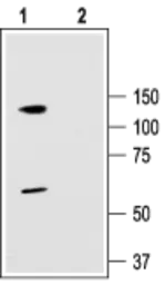 Anti-KCNC3 antibody used in Western Blot (WB). GTX16682