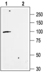 Anti-KCNN3 antibody used in Western Blot (WB). GTX16683