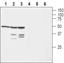 Anti-Kv beta 1 antibody used in Western Blot (WB). GTX16705