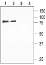 Anti-ENaC Beta antibody used in Western Blot (WB). GTX16967