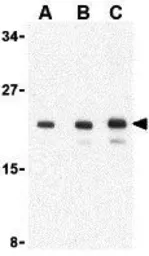 Anti-AES antibody used in Western Blot (WB). GTX16982