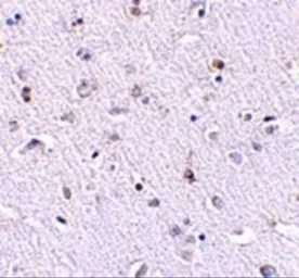 Anti-NANOS1 antibody used in IHC (Paraffin sections) (IHC-P). GTX17009