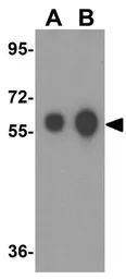 Anti-ALDH5A1 antibody used in Western Blot (WB). GTX17016