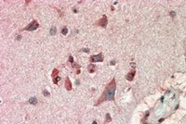 Anti-FBXL2 antibody, N-term used in IHC (Paraffin sections) (IHC-P). GTX17018