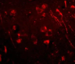Anti-AIPL1 antibody used in IHC (Paraffin sections) (IHC-P). GTX17027