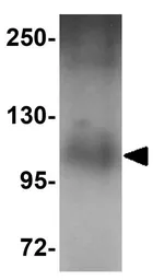 Anti-PLEKHM1 antibody used in Western Blot (WB). GTX17056