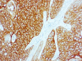 Anti-Cytokeratin 5 + 6 antibody [D5/16 B4] (ready-to-use) used in IHC (Paraffin sections) (IHC-P). GTX17068