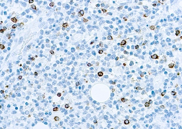Anti-EBV antibody [CS1, CS2, CS3, CS4] used in IHC (Paraffin sections) (IHC-P). GTX17085