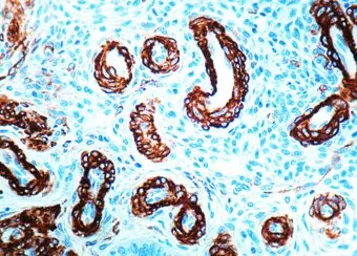 Anti-Muscle Actin antibody [1A4+5C5] used in IHC (Paraffin sections) (IHC-P). GTX17146