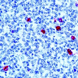 Rabbit Anti-Human IgM antibody. GTX17150