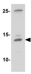 Anti-MIP1 beta antibody used in Western Blot (WB). GTX17201