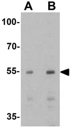 Anti-AMIGO1 antibody used in Western Blot (WB). GTX17210
