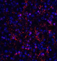 Anti-Orai1 antibody [3F6H5] used in IHC (Paraffin sections) (IHC-P). GTX17287