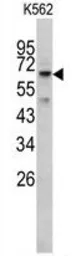 Anti-RIOK1 antibody used in Western Blot (WB). GTX17382