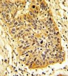 Anti-RIOK1 antibody used in IHC (Paraffin sections) (IHC-P). GTX17382