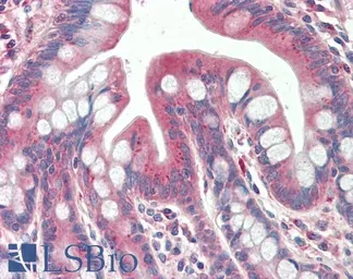 Anti-TXNDC11 antibody used in IHC (Paraffin sections) (IHC-P). GTX17445
