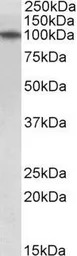 Anti-TXNDC11 antibody used in Western Blot (WB). GTX17445