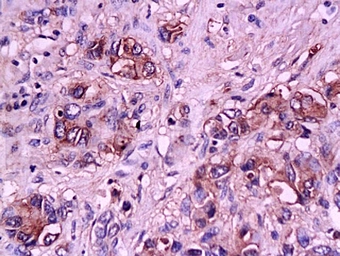 Anti-CD62E antibody used in IHC (Paraffin sections) (IHC-P). GTX17548