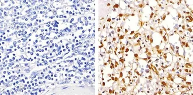 Anti-NFkB p65 (phospho Ser529) antibody used in IHC (Paraffin sections) (IHC-P). GTX17575