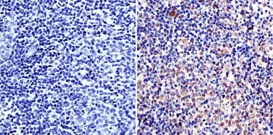 Anti-TOR1AIP1 antibody [RL13] used in IHC (Paraffin sections) (IHC-P). GTX17579