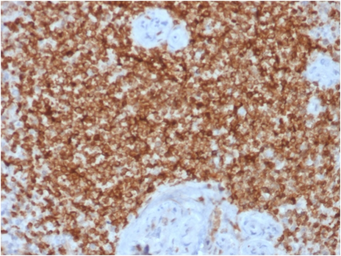 Anti-Bcl-2 antibody [BCL2/1878R] used in IHC (Paraffin sections) (IHC-P). GTX17715