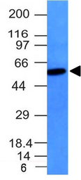 Anti-Vimentin antibody [VM452] used in Western Blot (WB). GTX17723