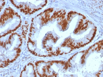 Anti-Estrogen Receptor alpha antibody [ESR1/1935] used in IHC (Paraffin sections) (IHC-P). GTX17904