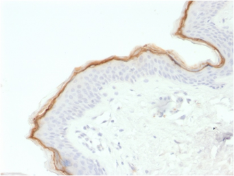 Anti-Filaggrin antibody [FLG/1563] used in IHC (Paraffin sections) (IHC-P). GTX17962