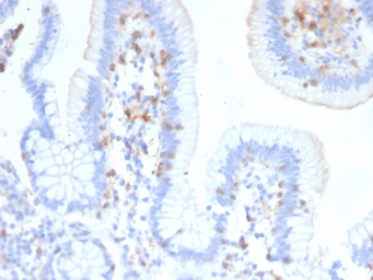 Anti-Integrin alpha E antibody [ITGAE/2474] used in IHC (Paraffin sections) (IHC-P). GTX17969