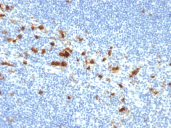 Anti-Integrin alpha E antibody [ITGAE/2474] used in IHC (Paraffin sections) (IHC-P). GTX17969
