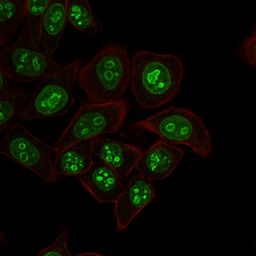 Anti-Ki67 antibody [MKI67/2462] used in Immunocytochemistry/ Immunofluorescence (ICC/IF). GTX17971