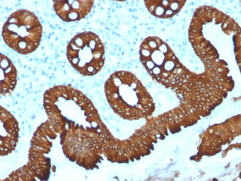 Anti-Cytokeratin 20 antibody [KRT20/1992] used in IHC (Paraffin sections) (IHC-P). GTX17981