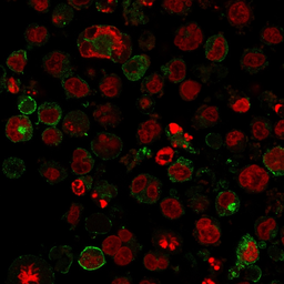 Anti-GluT1 antibody [GLUT1/2475] used in Immunocytochemistry/ Immunofluorescence (ICC/IF). GTX17986