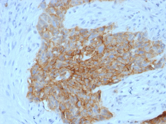 Anti-GluT1 antibody [GLUT1/2475] used in IHC (Paraffin sections) (IHC-P). GTX17986