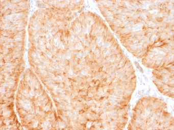 Anti-GluT1 antibody [GLUT1/2475] used in IHC (Paraffin sections) (IHC-P). GTX17986
