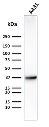 Anti-GluT1 antibody [GLUT1/2475] used in Western Blot (WB). GTX17986