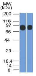 Anti-CD10 antibody [MME/1892] used in Western Blot (WB). GTX18043
