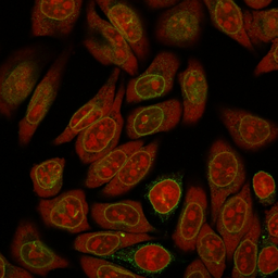 Anti-Emerin antibody [EMD/2167] used in Immunocytochemistry/ Immunofluorescence (ICC/IF). GTX18054