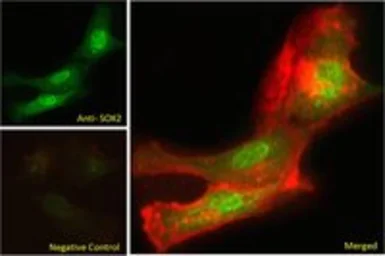 Anti-SOX2 antibody used in Immunocytochemistry/ Immunofluorescence (ICC/IF). GTX18149
