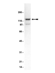 Anti-Neurabin 2 antibody used in Western Blot (WB). GTX18561