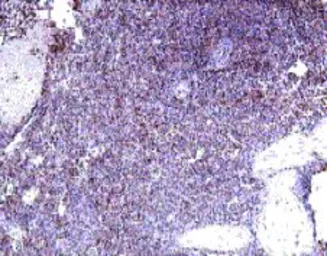 Anti-IL22 Receptor alpha 2 antibody used in IHC (Paraffin sections) (IHC-P). GTX18566