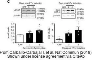 Anti-LAMP1 antibody used in Western Blot (WB). GTX19294