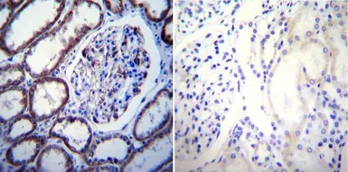 Anti-Calcium Sensing Receptor antibody [5C10, ADD] used in IHC (Paraffin sections) (IHC-P). GTX19347