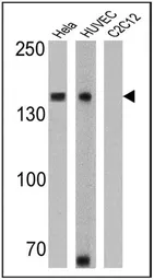 Anti-N-Cadherin antibody [8C11] used in Western Blot (WB). GTX19348