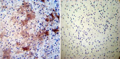 Anti-CRMP5 antibody [CR-1] used in IHC (Paraffin sections) (IHC-P). GTX19378